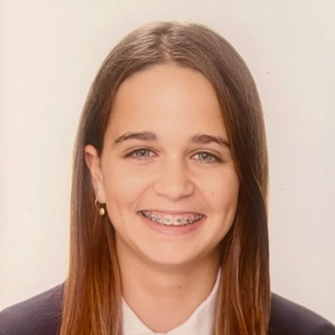 CANDELA LANCINA AREAN
